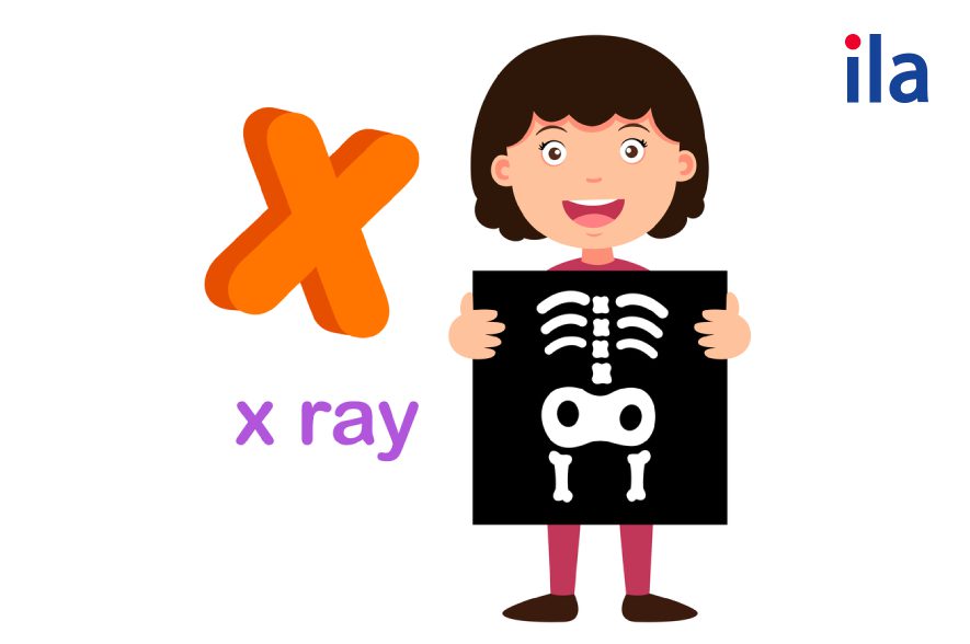 x ray 