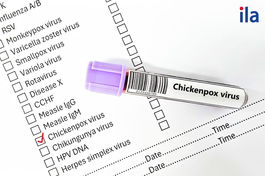 Những lưu ý trước khi tiêm phòng